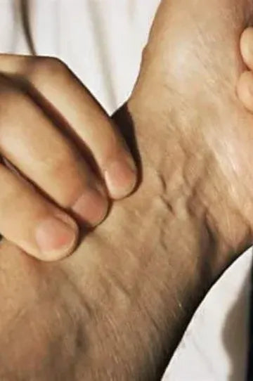 Best Ayurvedic Medicine for Neurological Problems