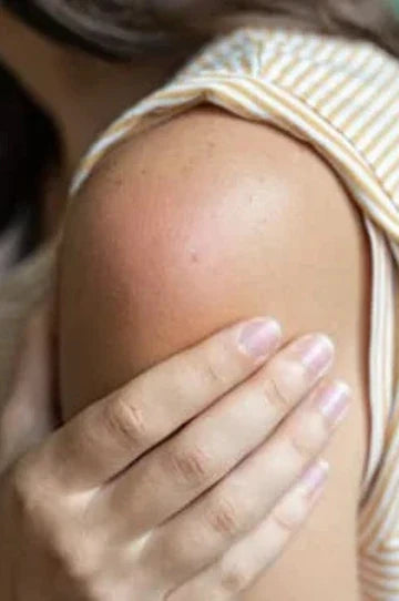 Best Natural Remedies for Swelling After Surgery | Amiy