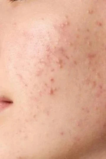 Best Ayurvedic Skin Care Products: Clear, Calm, Glowing