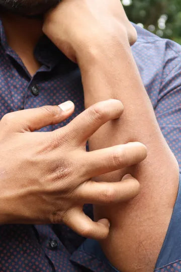 Ayurvedic Medicine for Allergy Relief: Simple Steps