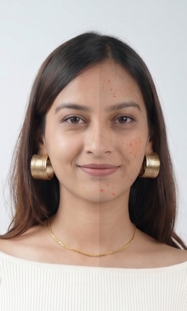 Heal Acne from Within: The Gut-Skin Axis & Hormonal Acne Solution