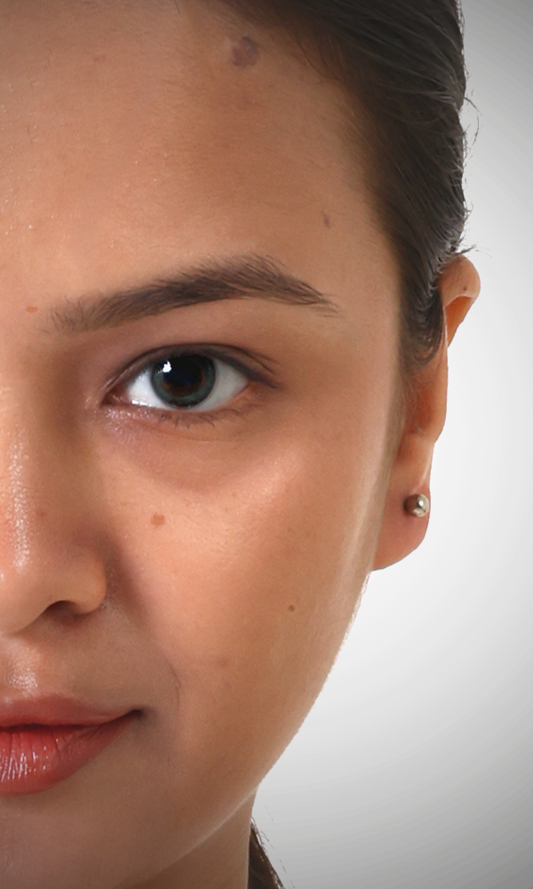Black Pimple on Face: Why It Keeps Appearing and What Is Actually Driving It