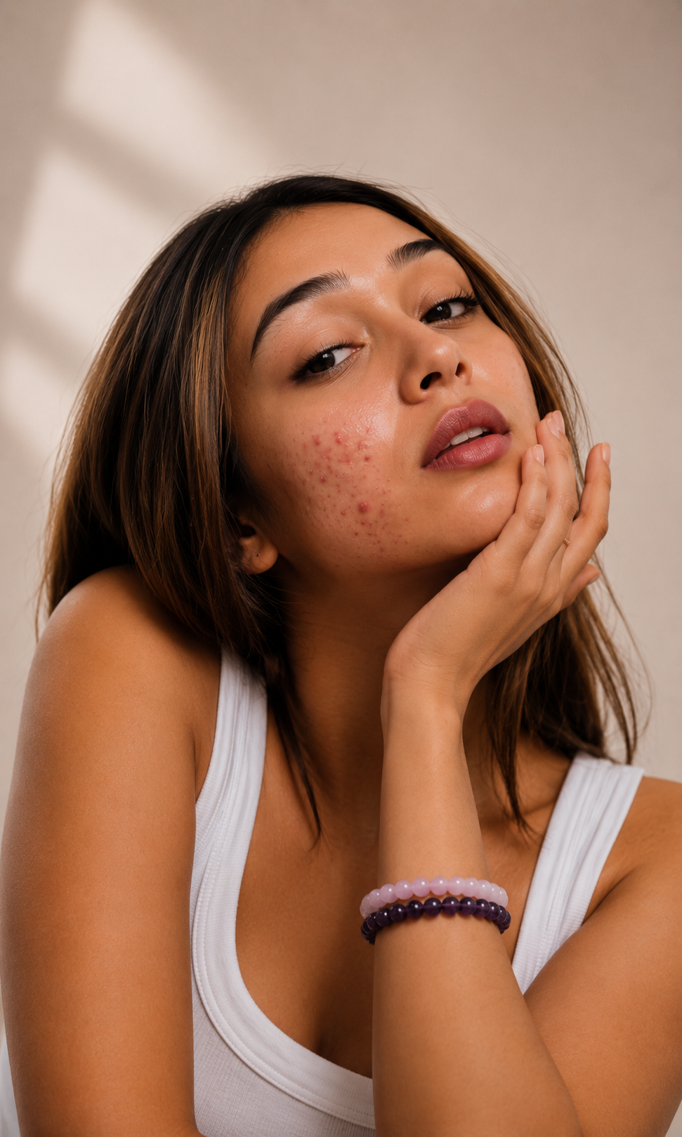 Why Hormonal Acne Is More Than a Skin Problem