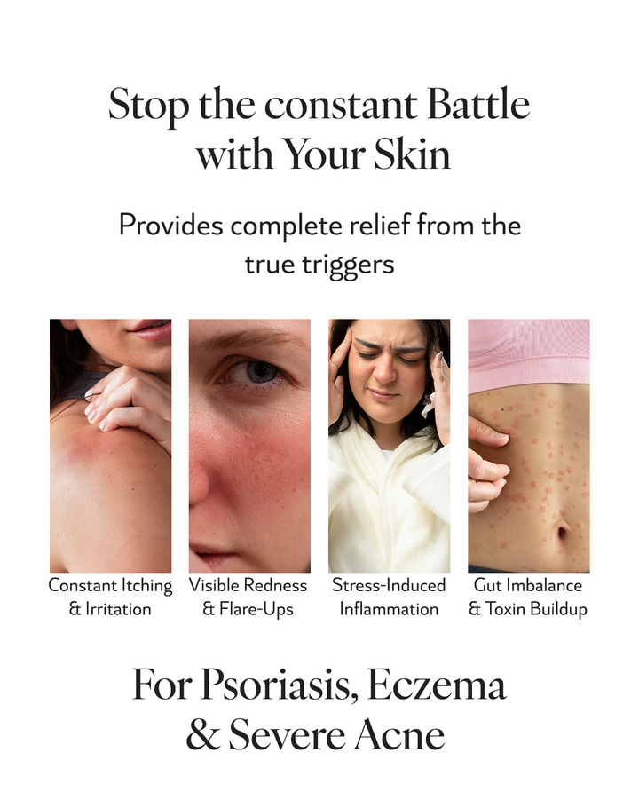 Psoriasis Care Pack mini | 3 Step Ayurvedic Healing For Calmer Skin And Stronger Immunity Bio Neuromodulation™ + Herbal Plant Elixir™ | Relief Within 30 Min Naturally From Inside Out