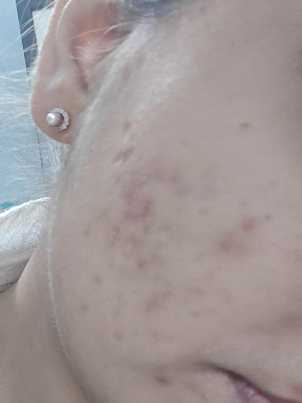 After