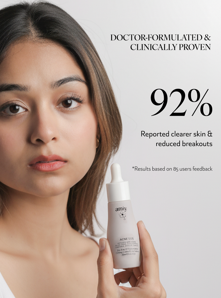 Acne SOS 100% relief within 30 Min Naturally from itch, redness, breakouts, pimples & inflammation oral drops