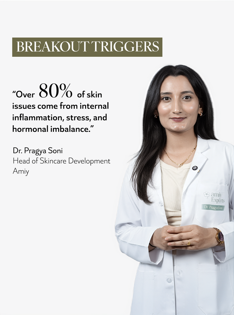 Acne SOS 100% relief within 30 Min Naturally from itch, redness, breakouts, pimples & inflammation oral drops