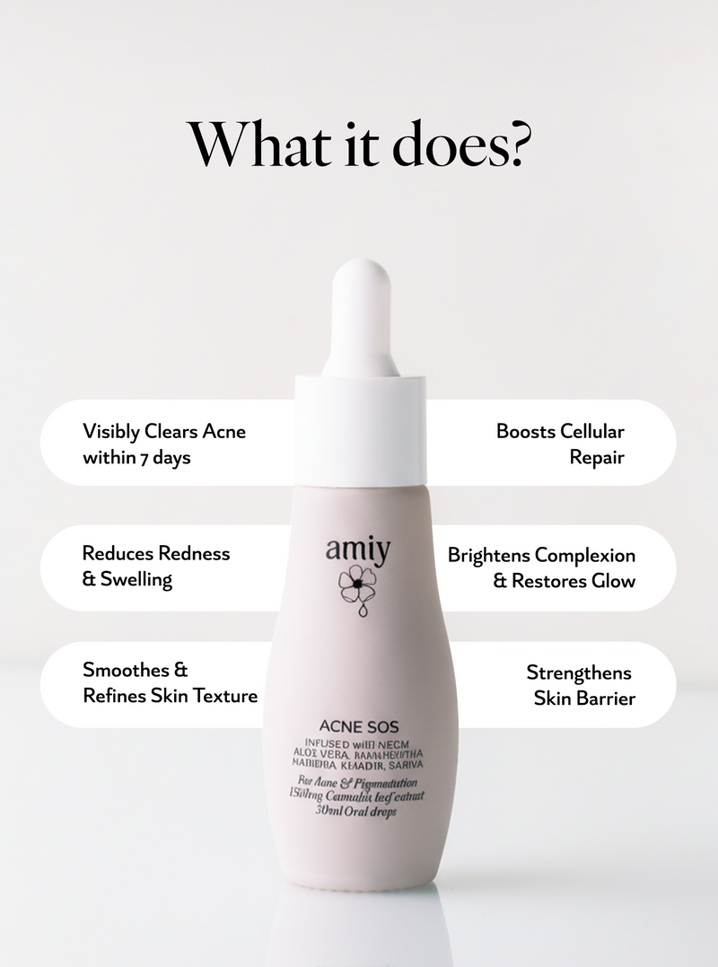 Acne SOS 100% relief within 30 Min Naturally from itch, redness, breakouts, pimples & inflammation oral drops